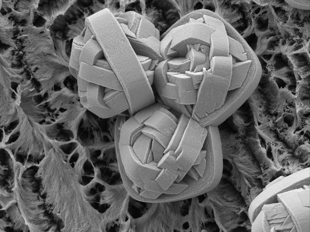 Three TiO2 defects on the surface of a heart stent